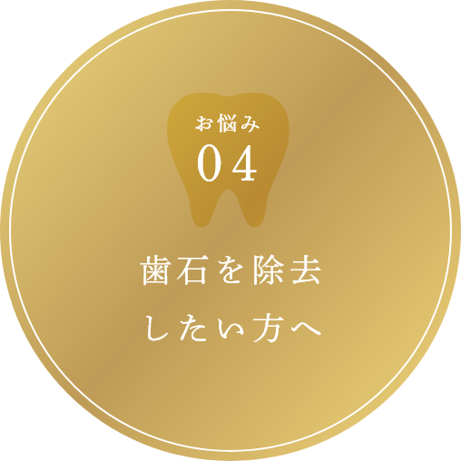 歯石を除去したい方へ