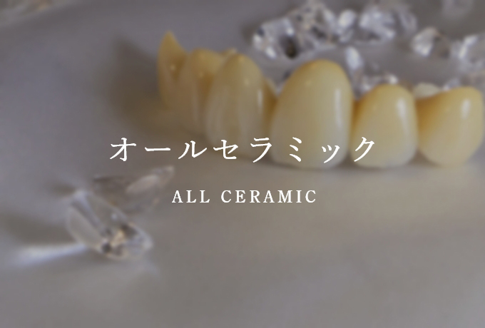 オールセラミック